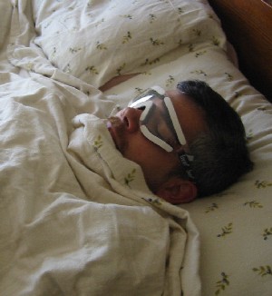 Bill asleep after surgery wearing sexy goggles.